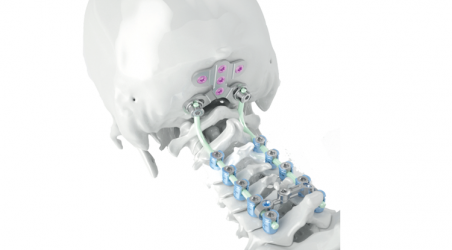 Cervical